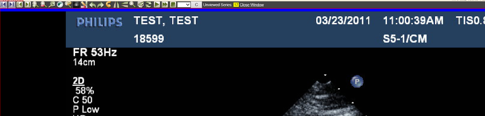 8721d596f77da2ae116777a83a0750e1